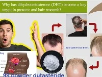 Miért vált a DHT kulcsfontosságú célponttá a prosztata- és hajkutatásban?